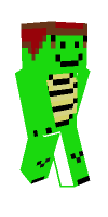 Skin preview